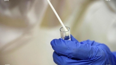 Les tests antigéniques disponibles dans les pharmacies de l' ... Image 1
